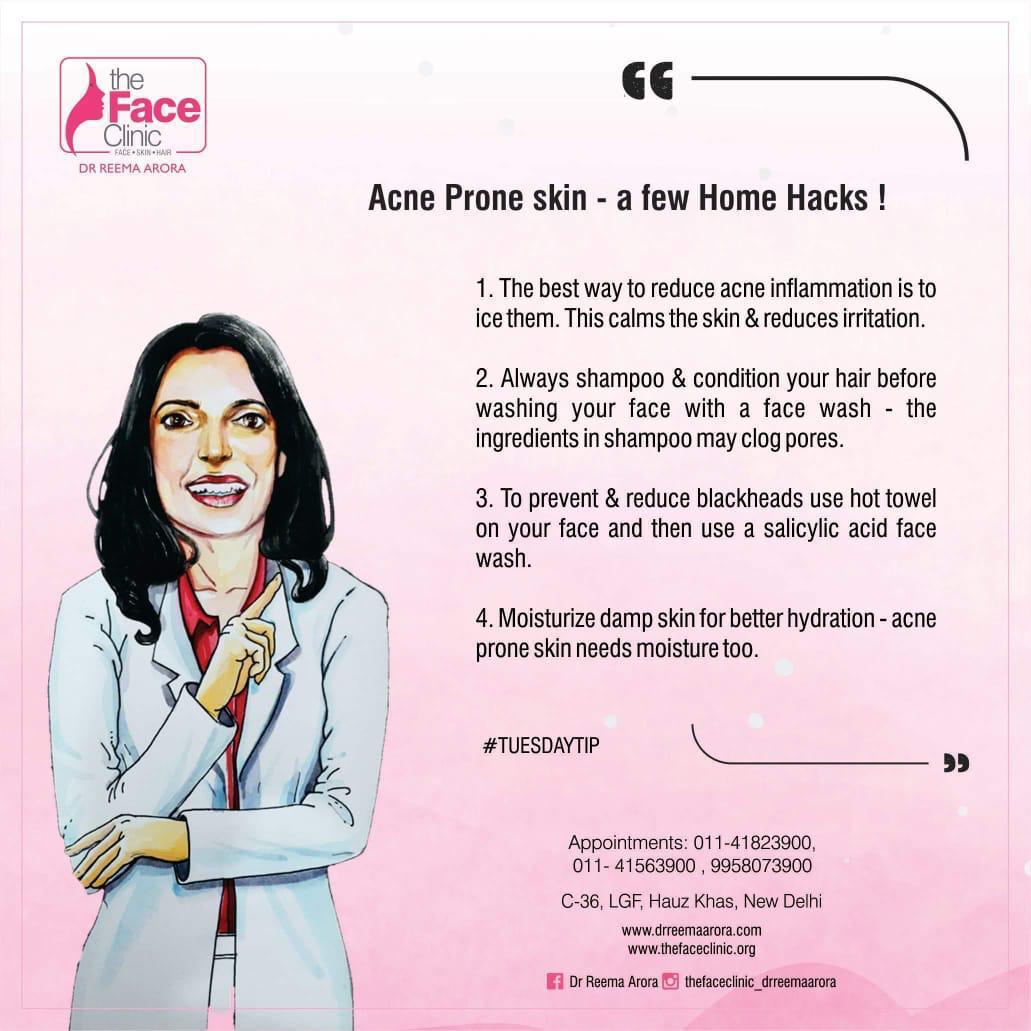 Acne Prone Skin _ A Few Home Hacks