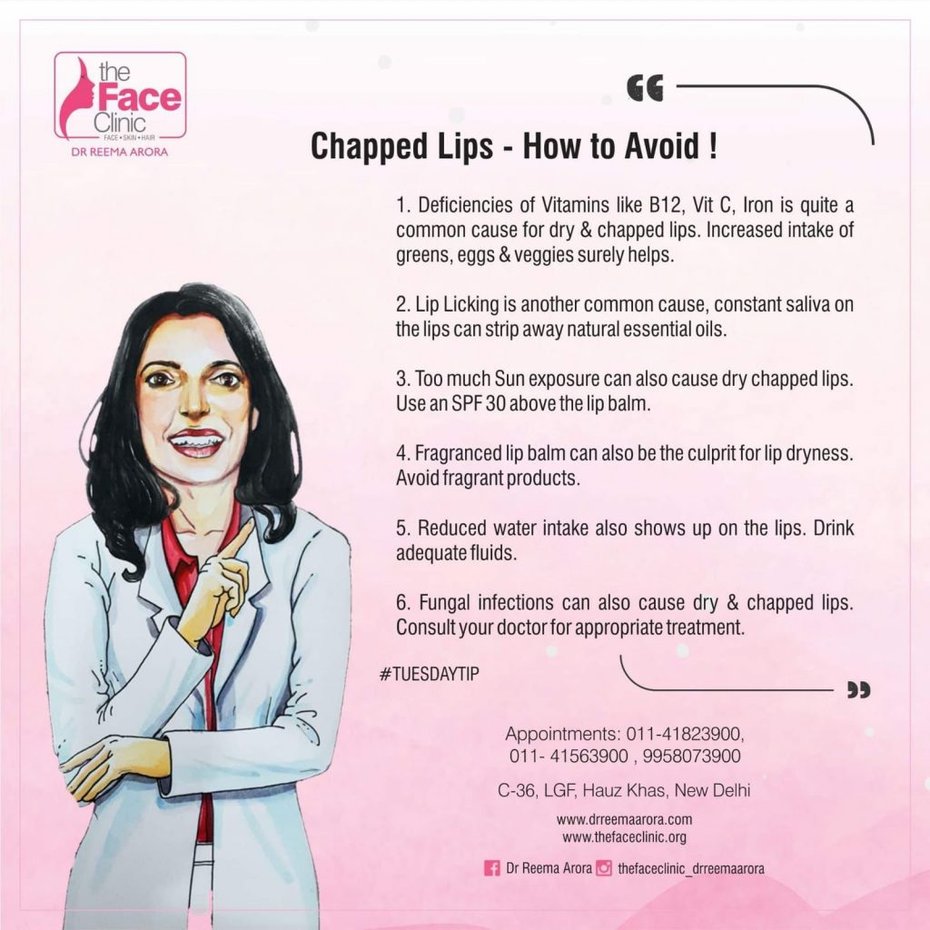 Chapped lips - How To Avoid