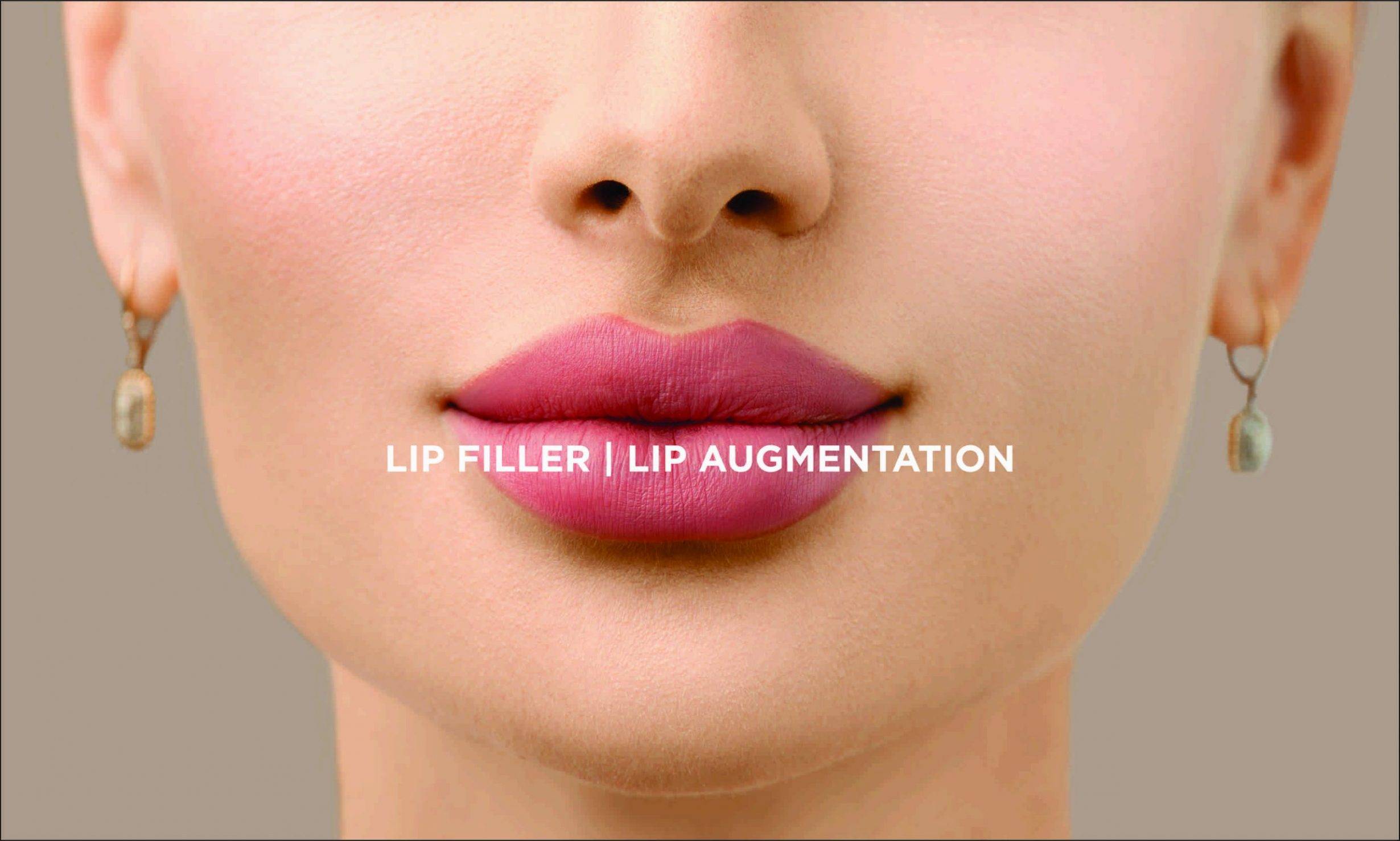Lip Filler in Delhi | Lip Enhancement | Lip Fillers Cost in India