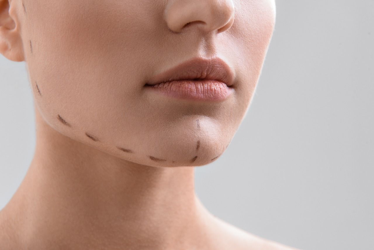 Transform Your Chin: Affordable Non-Surgical Fillers in Delhi, India