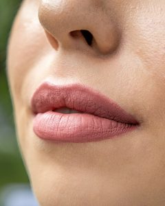 Lip Fillers Enhancing Your Beauty with Fuller, Luscious Lips