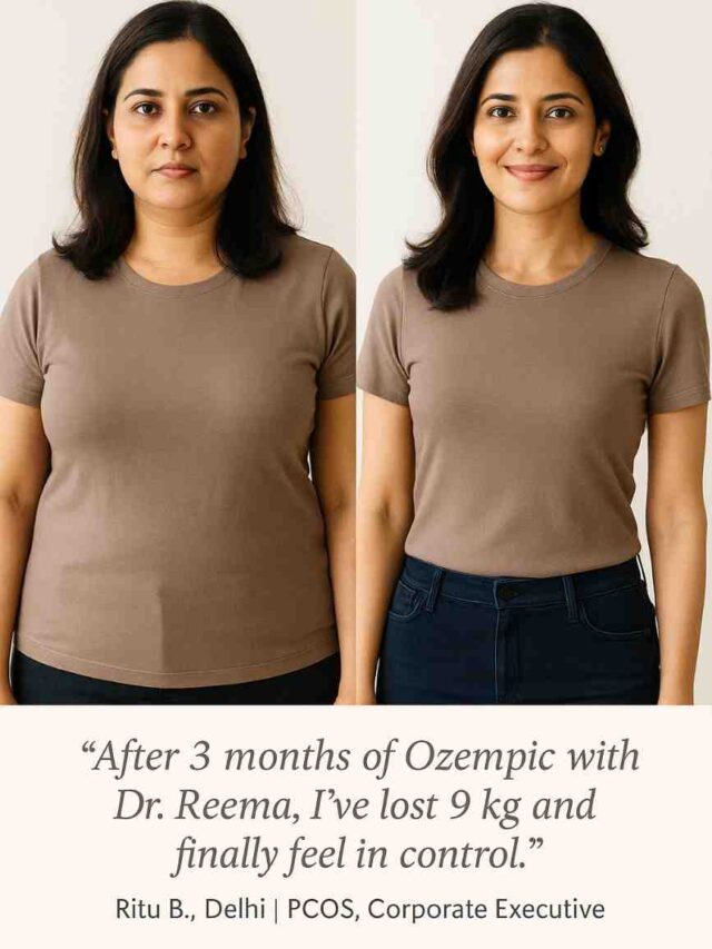 Side-by-side visual showing real patient before and after Ozempic weight loss results under doctor supervision at a leading clinic in South Delhi, India.