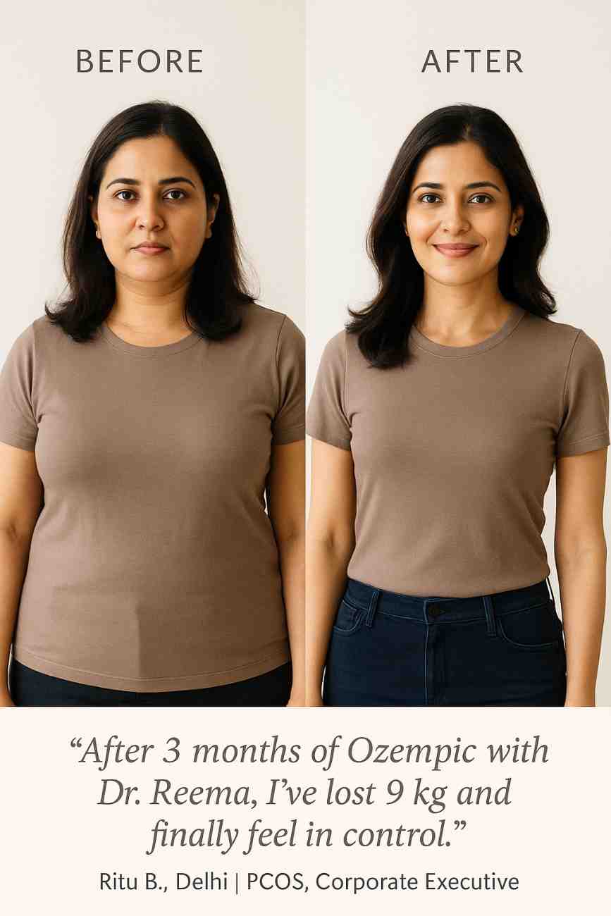 Side-by-side visual showing real patient before and after Ozempic weight loss results under doctor supervision at a leading clinic in South Delhi, India.