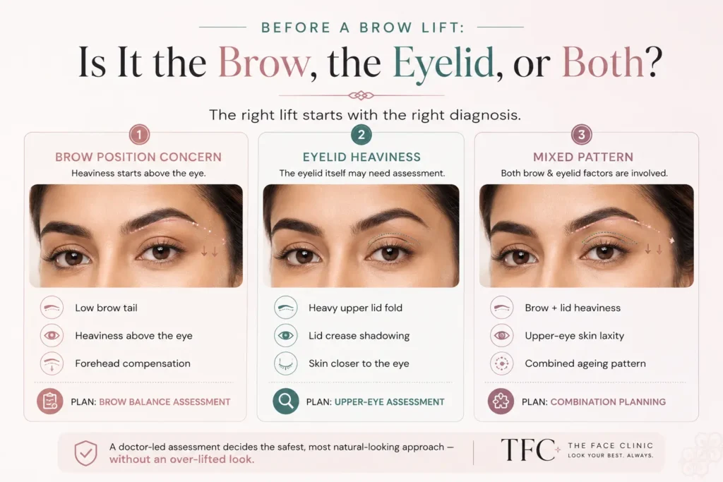 Decision board visual explaining the difference between brow position concern, eyelid heaviness, and mixed-pattern upper-eye heaviness for doctor-led brow lift assessment at The Face Clinic.
