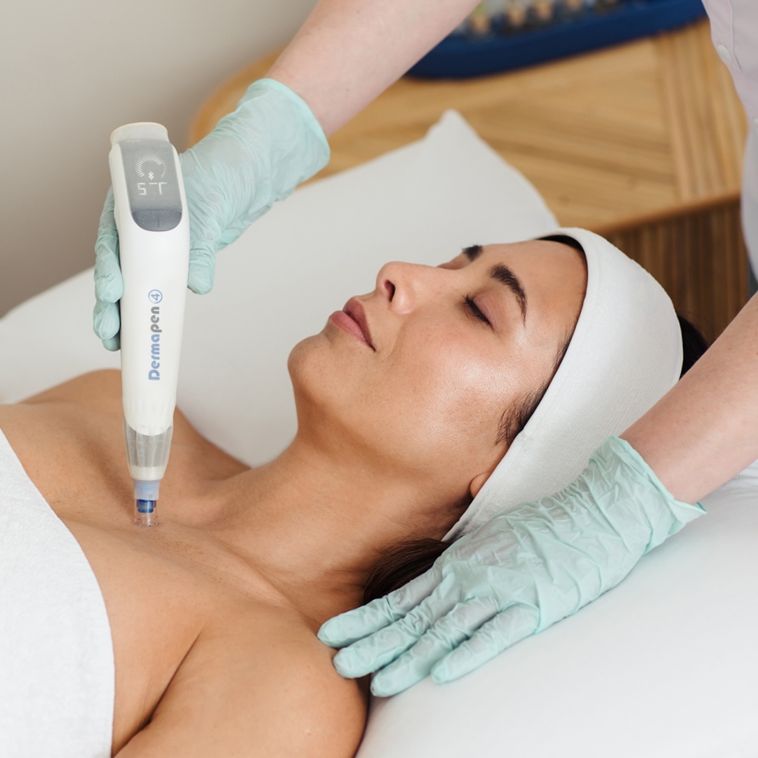 Dermapen 4 Treatment Price in Delhi Dermapen 4 Scar Treatment in India #1
