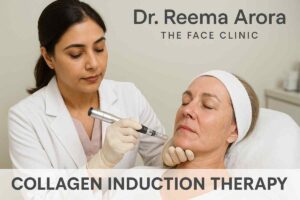 Dr. Reema Arora at The Face Clinic performing collagen induction therapy using a microneedling device on a patient in South Delhi.