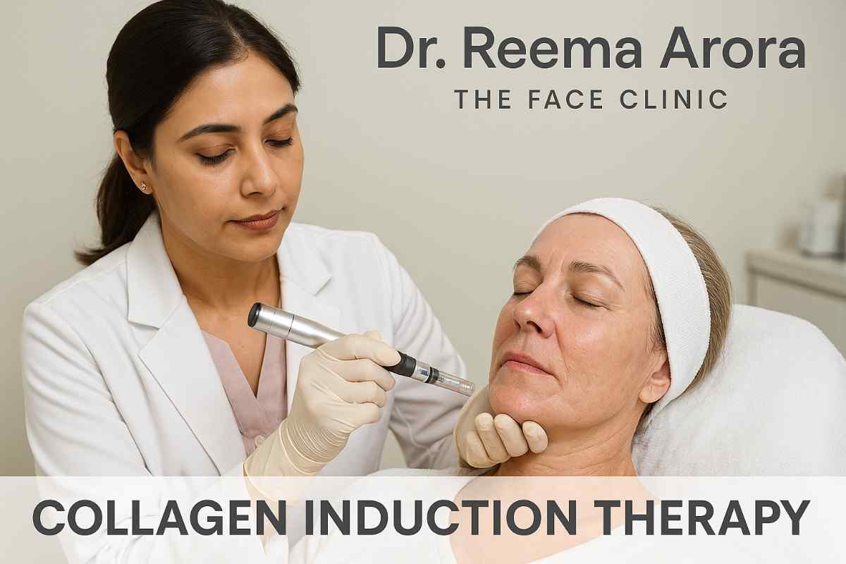 Dr. Reema Arora at The Face Clinic performing collagen induction therapy using a microneedling device on a patient in South Delhi.