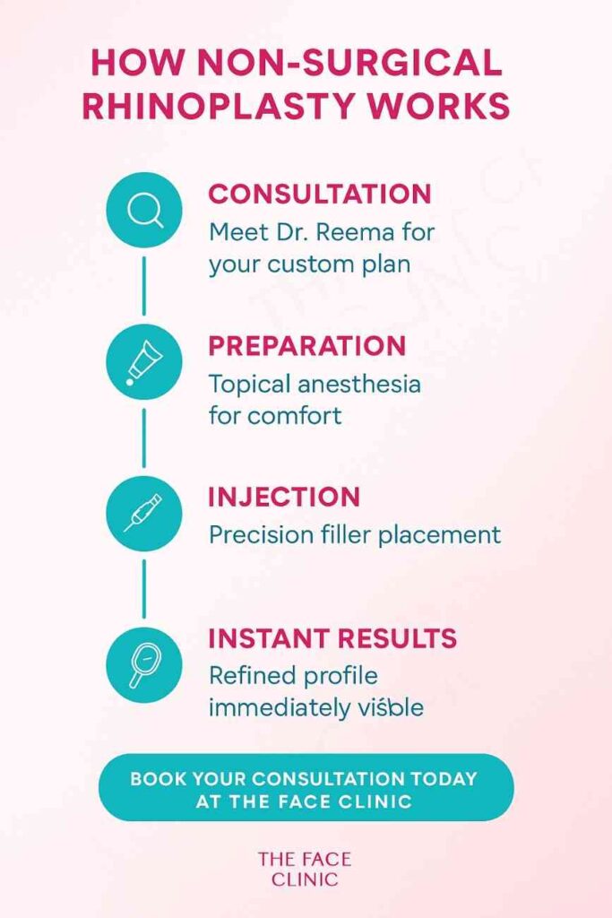 How non-surgical rhinoplasty works – step by step infographic | Liquid nose job in Delhi & India | The Face Clinic | Non-surgical nose reshaping with fillers, consultation to instant results