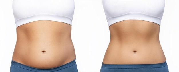 Transform Your Body with CoolSculpting – Real Results at The Face Clinic, Delhi