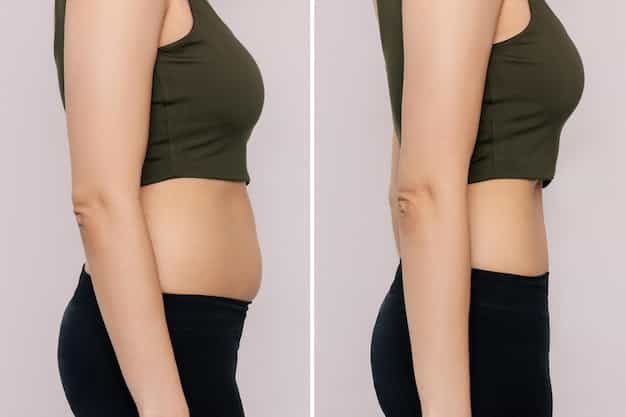 Sculpted Contours, Lasting Results – CoolSculpting Transformations by Dr. Reema Arora