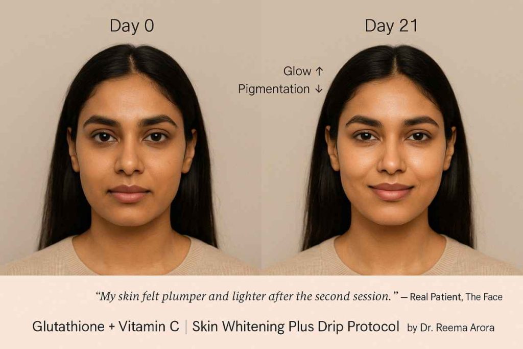 Before and after IV therapy results at The Face Clinic, India showing improved hydration, glowing skin, and wellness transformation.