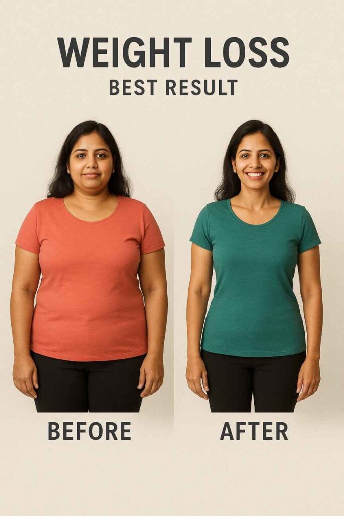 Best weight loss results in India – Indian woman before and after medical weight loss treatment in Delhi